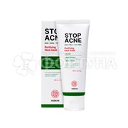 Маска для лица Hiskin Stop Acne 100 мл Очищающая  AHA + BHA + TEA TREE
