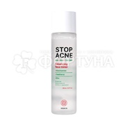 Тонер Hiskin Stop Acne 150 мл Балансирующий AHA + BHA + TEA