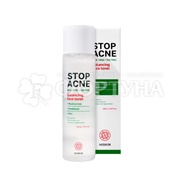Тонер Hiskin Stop Acne 150 мл Балансирующий AHA + BHA + TEA