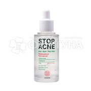 Сыворотка Hiskin Stop Acne 50 мл Себорегулирующая для лица AHA + BHA + TEA TREE