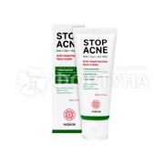 Крем для лица Hiskin Stop Acne 50 мл против несовершенств AHA + BHA + TEA TREE